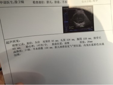 怀孕35周还有多久生产