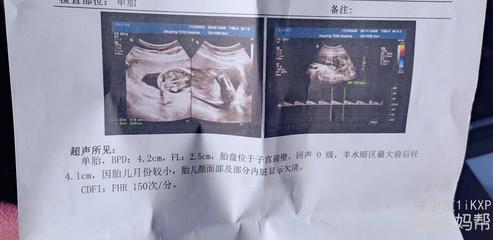 十七周胎儿