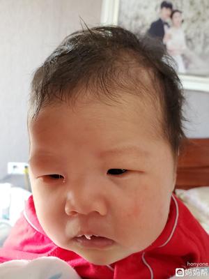 宝宝有绿色眼屎怎么回事