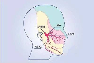 脑神经抽搐是怎么回事