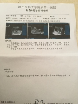 多囊怀孕
