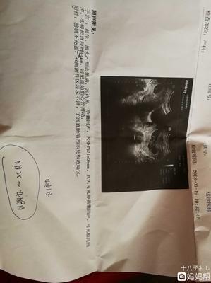 胎儿10周有多大