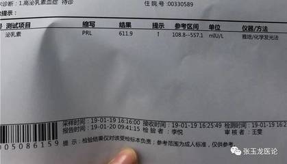 泌乳素高怎么治疗好