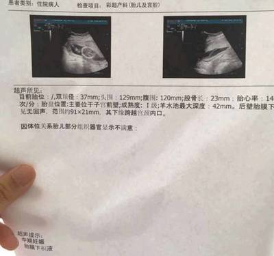 怀孕半个月会流产吗