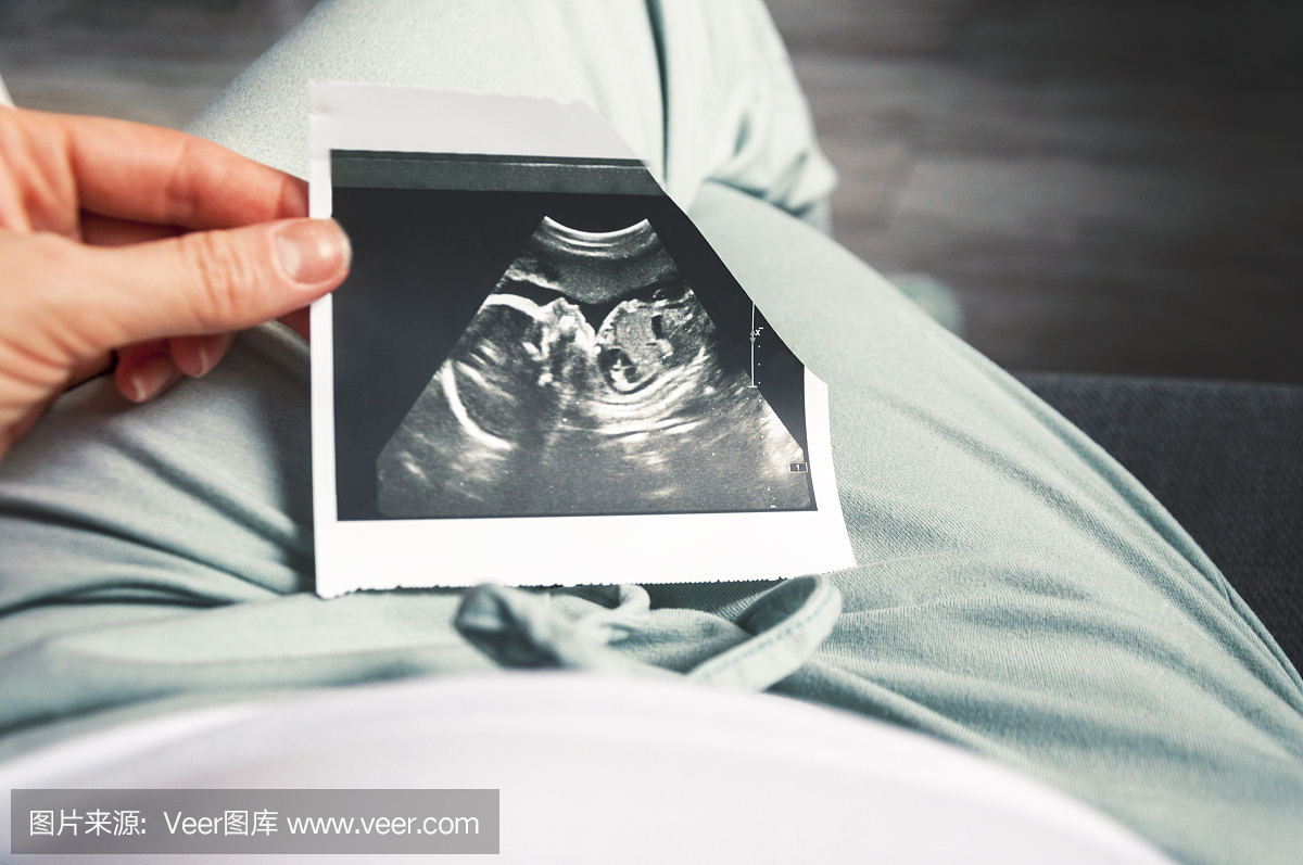 胎儿20周的大小图片图片