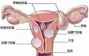 排卵期出血和月经的区别