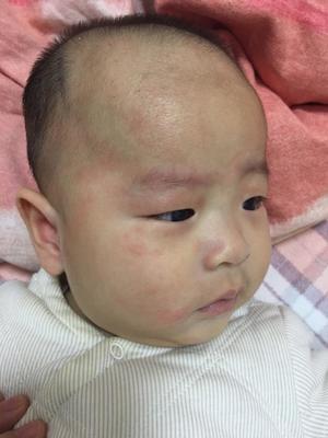 小孩老是摇头是怎么回事