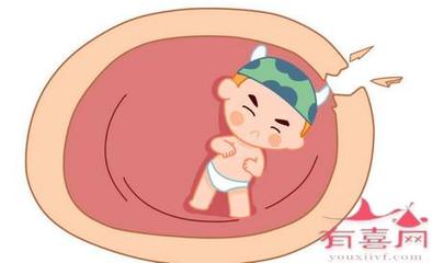 胎膜早破对胎儿影响