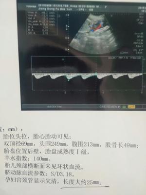 怀孕6个多月胎动少正常吗