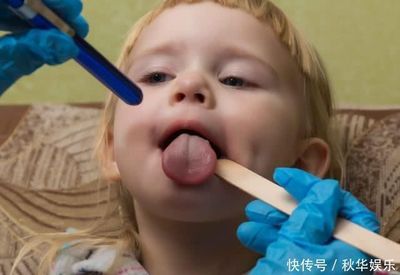 宝宝舌尖红是什么原因