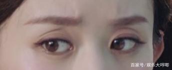 眼眶深陷是怎么回事