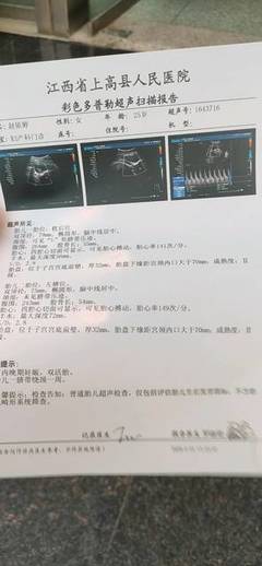 胎儿几周算足月