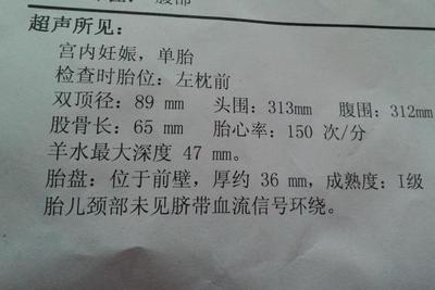 8个月头围