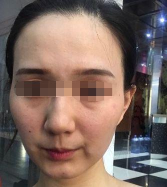 人中歪斜的面相