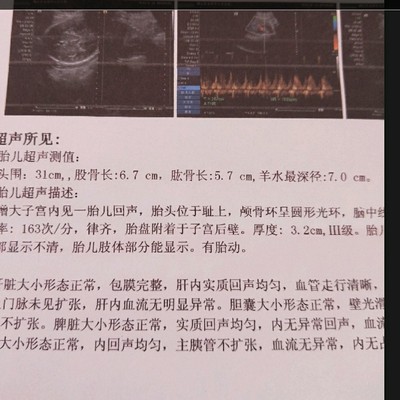 胎儿头位是入盆了吗