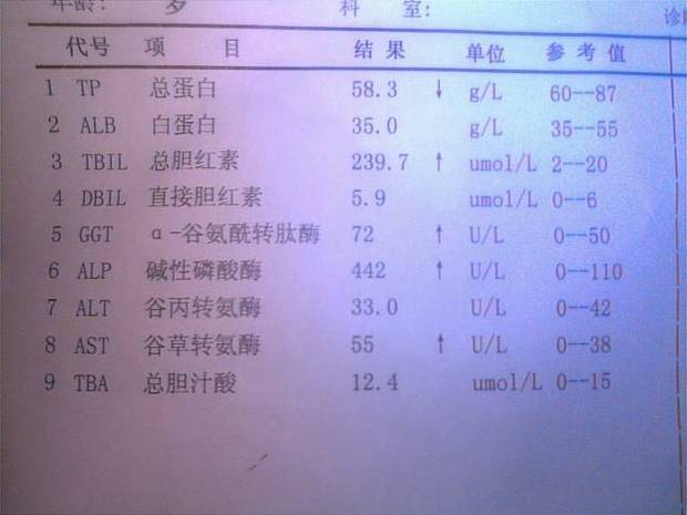 胆红霉素高是怎么回事
