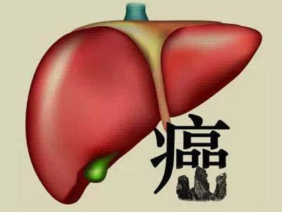 肝炎是怎么回事