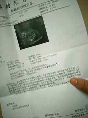 四个半月的胎儿有多大