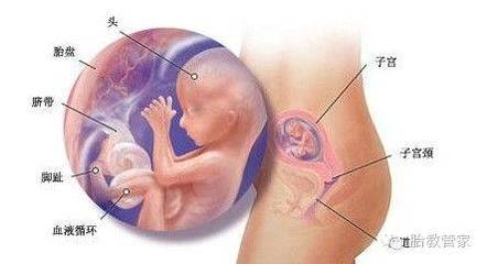 怀孕臀位怎么办