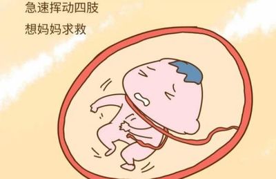 如何知道胎儿是否缺氧