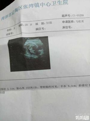 怀孕四个月怎么看男女