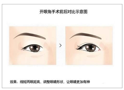 开眼角下至