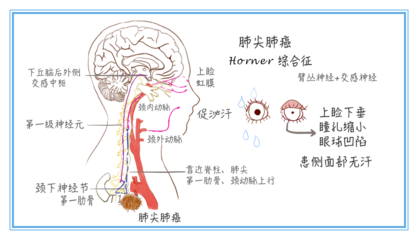 下丘脑综合征怎么治疗