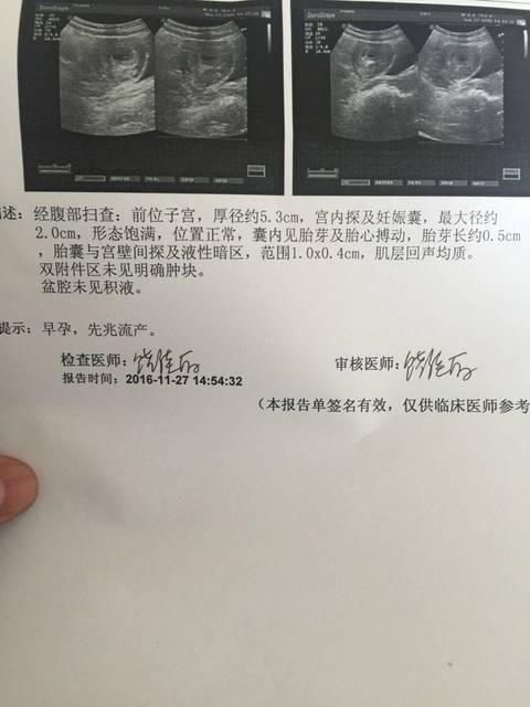 吃孕酮对胎儿有影响吗