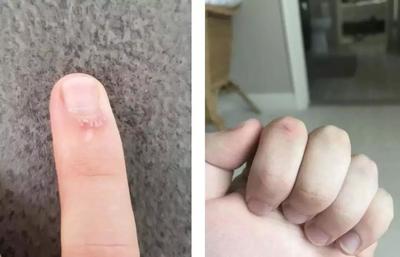 左手左胳膊麻是怎么回事