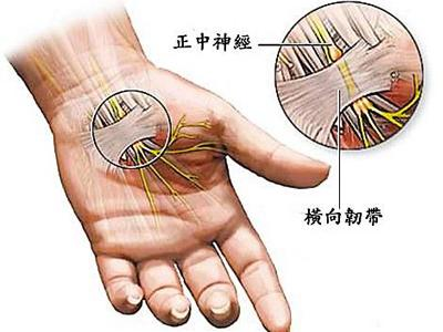 胳膊一直麻是怎么回事