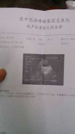 月经完第一天会怀孕吗
