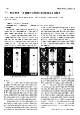 子宫拉出来