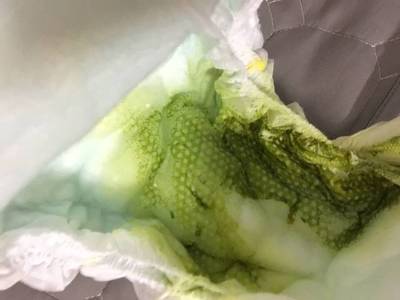 宝宝拉绿便怎么办