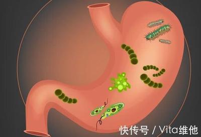 有幽门螺杆菌怎么治疗