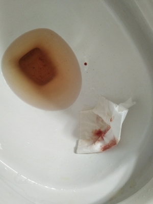 怀孕第一个月会来月经