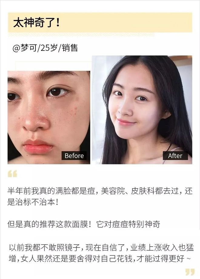 满脸痘痘可以做销售吗