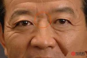 男人山根低的面相