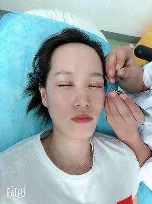 越然医疗美容靠谱吗