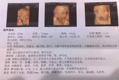 怀孕几个月能看出来男女