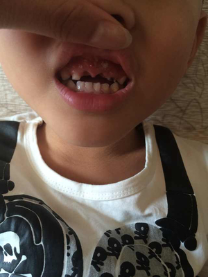 几个月长牙齿