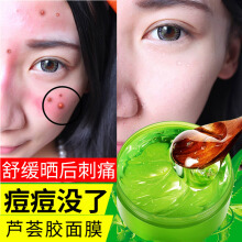 痘痘上涂了芦荟胶很痒