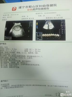 胎儿肾盂分离是什么意思