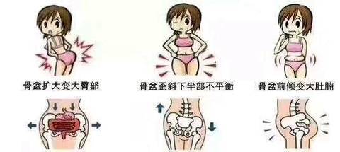 坐月子胯骨疼是怎么回事