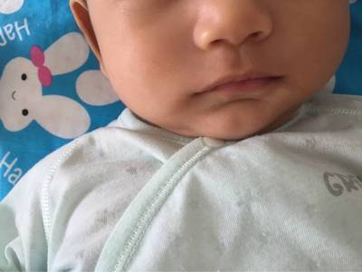 两个月婴儿贫血