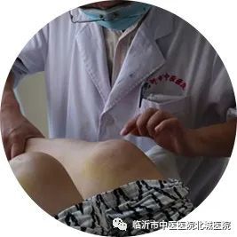 膝盖积液中医怎么治疗