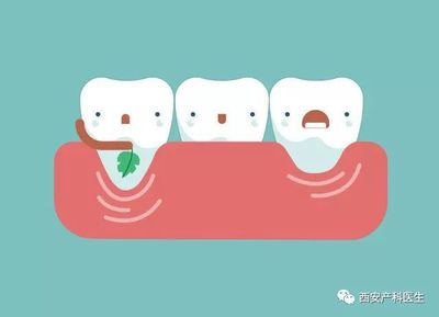 孕妇牙周炎