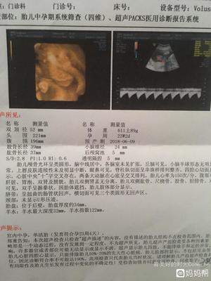 两个月胎儿图片