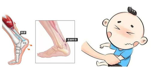 膝盖软是怎么回事