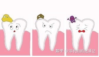 蛀牙引起的牙疼怎么办