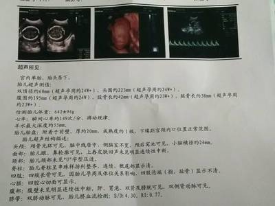三维四维彩超几个月做